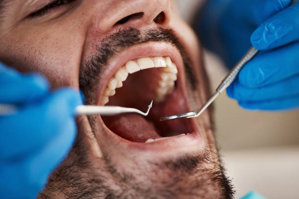 Best Emergency Tooth Extraction  in Farmington, IL