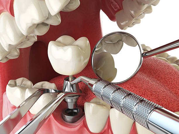 Best Root Canal Emergency Dentist  in Farmington, IL